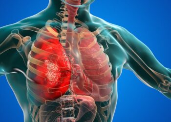 Simpatia para curar bronquite