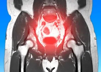 Miomas: o chamado do corpo para resgatar sua essência