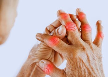 Artrite: como o corpo endurece o que o coração não consegue aceitar