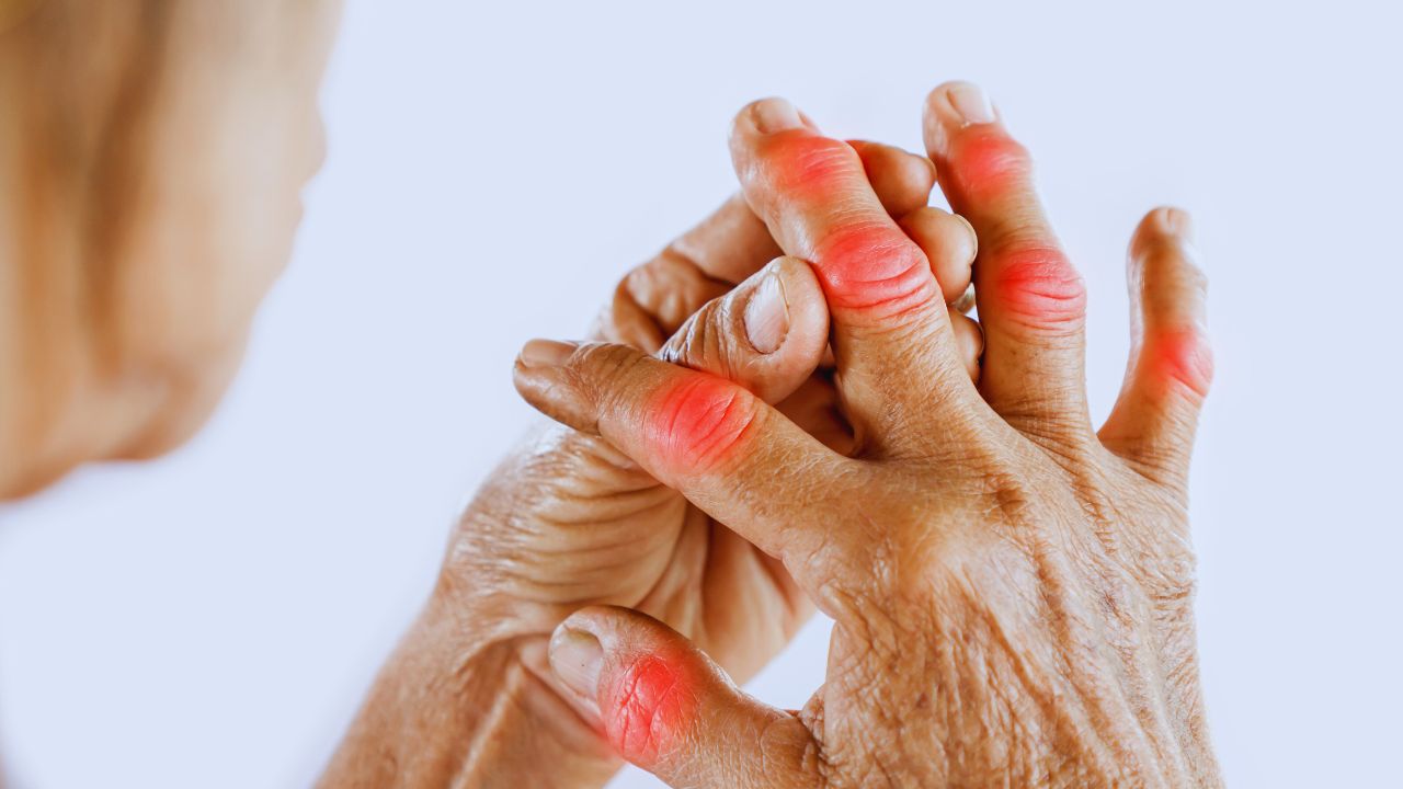 Artrite: como o corpo endurece o que o coração não consegue aceitar