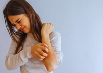 Psoríase e emoções: como a raiva e a vergonha afetam sua pele