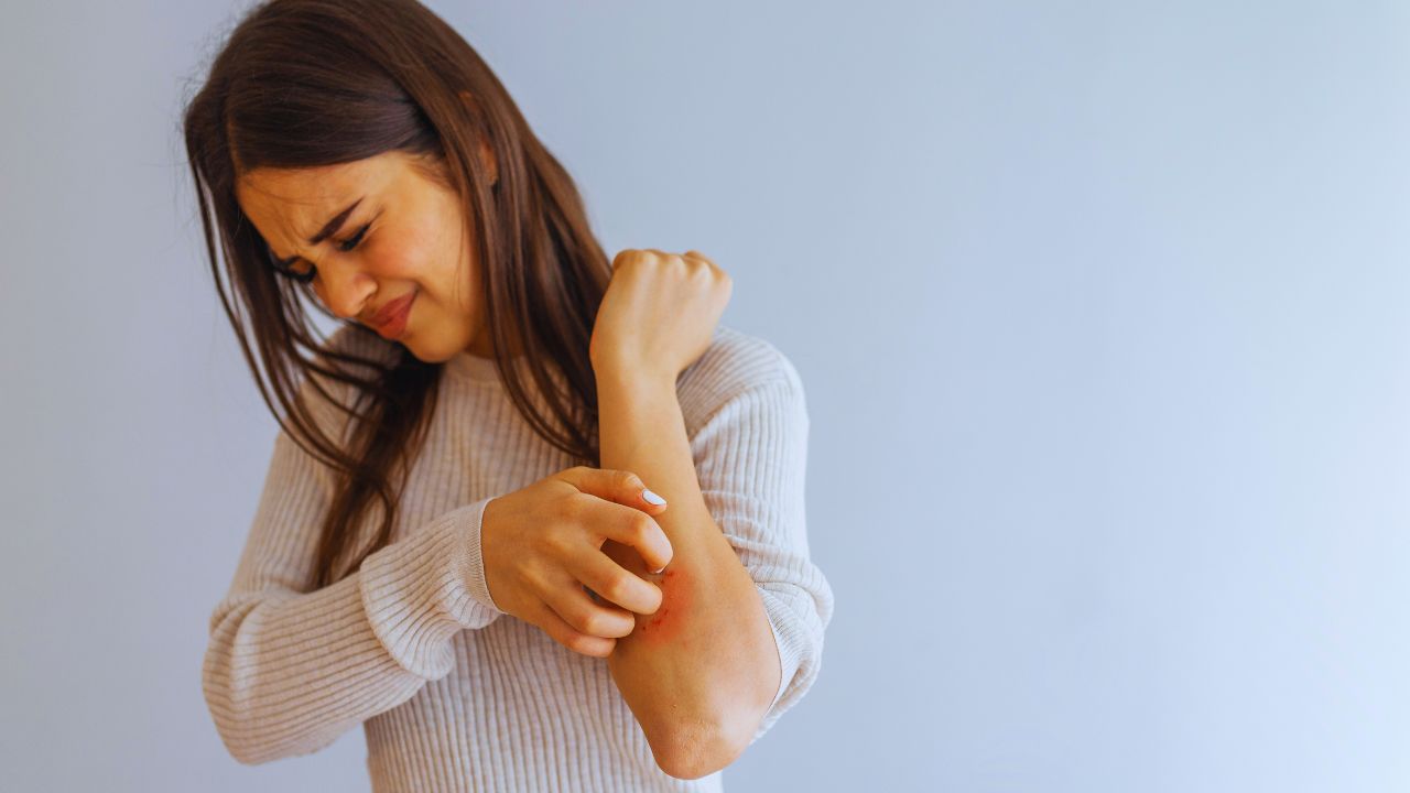 Psoríase e emoções: como a raiva e a vergonha afetam sua pele