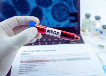 Brasil confirma 88 casos de Mpox em 2026 e expõe contraste nos dados de São Paulo